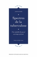 Spectres de la tuberculose: Une maladie du passé au temps présent